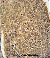IHC-P - ATG13 Antibody (N-term) AP9928a